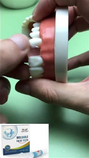 🦷 How to use the moldable plastic false tooth kit, here is the teaching video for you, easy, cheap