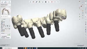Full Arch Implant Process Flow. #upcera #cadcam #dentallaboratory #zirconia #dentaltechnician | Upcera_Official