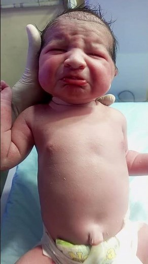 Active Newborn Baby | Strong Reflexes & Healthy Response #babys #neonatologist #babychoice #baby