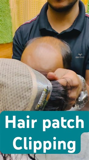 Hair patch clip system side effects #shorts #wigs #trending