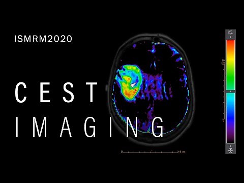 CEST imaging