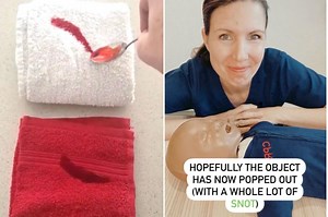 The one item nurses say every parent should have if their child is in need of first aid