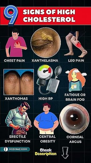 High Cholesterol Symptoms: What Your Body Is Trying to Tell You #healthyaging #seniorhealth #usa