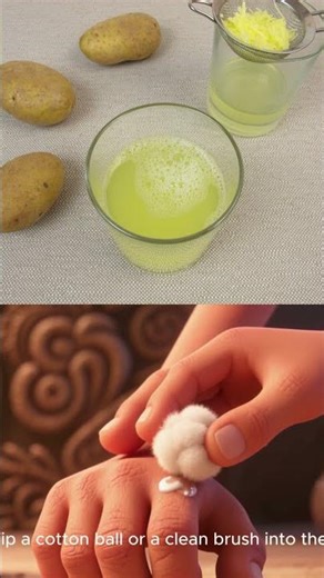 Hand knuckles |Dark knuckles treatment| How to get rid of dark knuckles ?