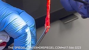 Lip Lift & Augmentation Advancements