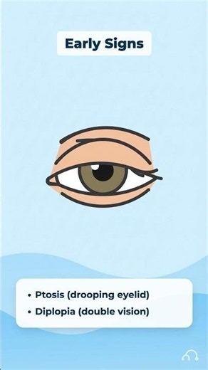 Myasthenia Gravis 📝