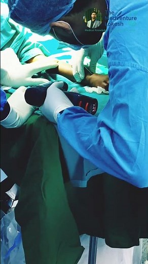 Real OT Surgery: Child’s Broken Arm Fixed with K-Wire 🔧 | Distal Radius & Ulna Fracture #shorts