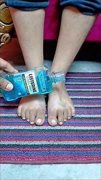 Just put Listerine on your feet and wait for morning! #shorts #tips