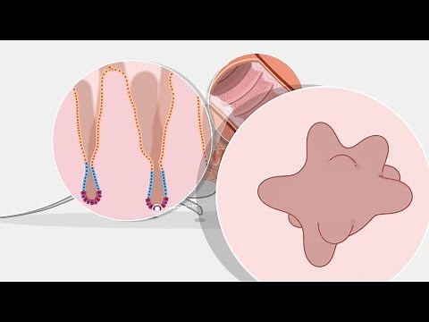 How to Culture Mouse Intestinal Organoids: Introduction