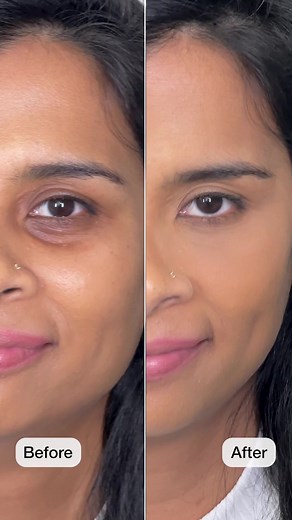 Huda Beauty Corrector Before and After Transformation