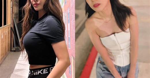 Legendary 2nd Generation Idols Admit Their Agencies Forced Plastic Surgery Onto Them