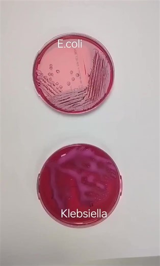Microbiology😍😍 #microbiology #lablife #MLT #medicallaboratoryscience | Lab life