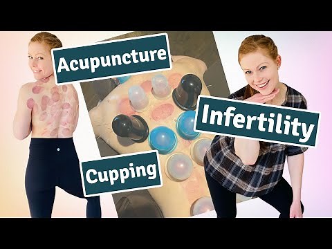 It Really Works! Acupuncture for Infertility | How Cupping Therapy Works | For Infertility