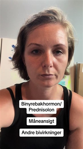 Prednisolon og Måneansigt: Mine Bivirkninger