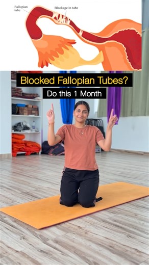 Mahak Khanna on Instagram: "👇 Poll : What kind of fallopian tube blockage do you have? Tubal blockage usually forms because of chronic inflammation, adhesions, hormonal imbalance, sluggish pelvic circulation, or muscular–fascial spasm and not because your body is incapable. Our Fertility Yoga and diet don’t ‘force open’ tubes. But They remove what’s creating the obstruction. Here’s how they help 👇 • Targeted yoga improves pelvic blood flow → oxygen + nutrients reach the tubes • Gentle inversio