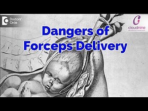 Is Forceps Delivery dangerous? - Dr. Sahana Hedge of Cloudnine Hospitals | Doctors’ Circle
