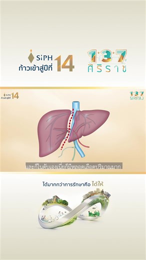 16K views · 309 reactions | da Vinci Robot Liver Surgery แม่นยำ...