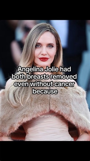 Angelina Jolie Underwent Major Surgery to Prevent Disease #hollywood #angelinajolie #celebrity