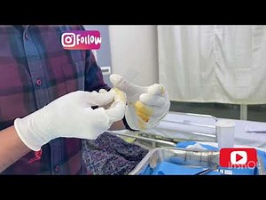 Ultrasound guided FNAC | Thyroid & Breast | Dr. Naveen kumar