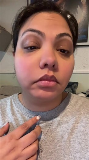 Post-Apicoectomy Care: Managing Swelling and Recovery