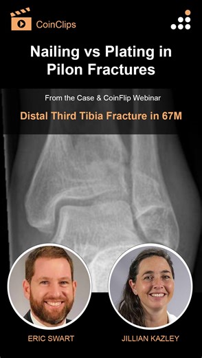 Here is a clip from our latest episode of CoinFlips & Controversies, “Distal Third Tibia Fracture in 67M” featuring expert faculty from the recent FOT Lower Extremity Dissection Course. Watch Drs. Swart & Kazley, discuss “Nailing vs Plating in Pilon Fractures”. Click here to learn more about the upcoming FOT Upper and Lower Extremity Dissection Course and watch their full webinar on Orthobullets: https://orthobullets.tiny.us/09302025 #orthopedic #orthopedics #orthopedicsurgery #orthopedicdoctor 