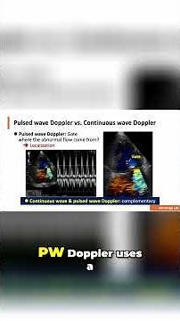 Doppler Explained: PW vs CW for Accurate Flow Measurement
