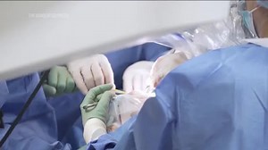 Electronic chip promises to bring relief to patients with sleep apnea