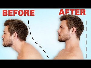How to Fix Forward Head Posture (FOREVER)