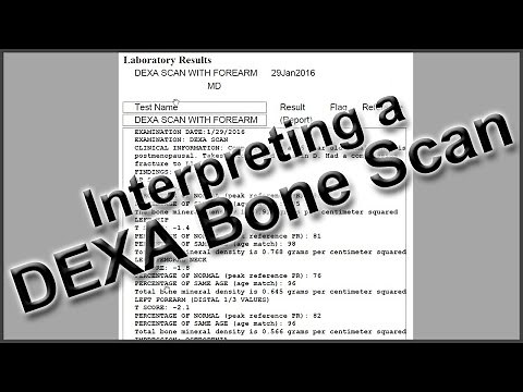 Interpreting a DEXA Bone Scan