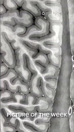 You've never seen human anatomy like this before