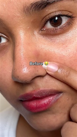 Glass Skin Using 1 Serum ⭐️ Pore Perfecting Serum 🌿 #glassskin #skincare #openpores #blackheads