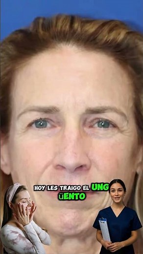 😱✨ Erase blemishes, wrinkles, and lines in days with THIS secret!