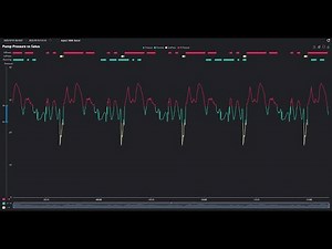 Complex Charting in Ignition Perspective