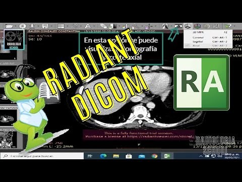 ✅Tutorial de funcionamiento RADIANT DICOM visualizador de imágenes medicas (TOMOGRAFIAS)