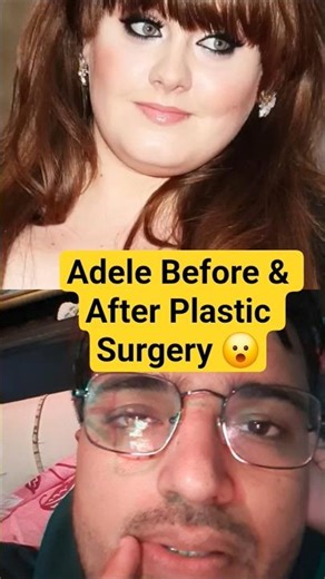 Adele’s Jaw-Dropping Glow Up 😳 | Real Story Behind Her Transformation!