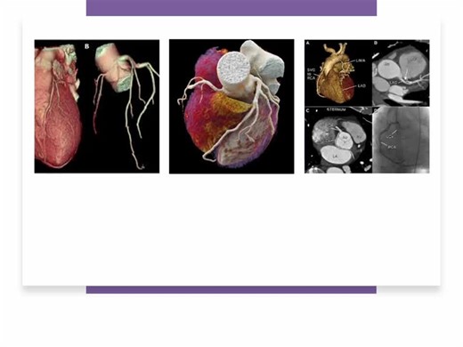 CTCA: A non-invasive imaging technique for coronary arteries | Ashish Sharma posted on the topic | LinkedIn