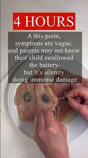 What happens when you swallow a button battery? Demo