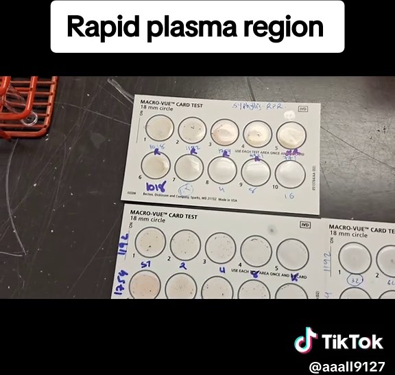 Rapid Plasma Region Test in Immunology Laboratories