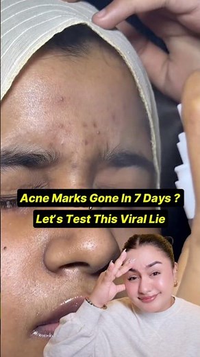 Why are they Lying -Dr Althea 345 mist Review !