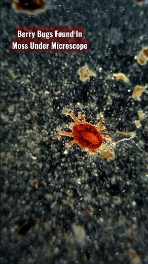BERRY BUGS AKA CHIGGERS UNDER MICROSCOPE