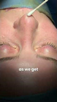 Natural Nose Job Transformation