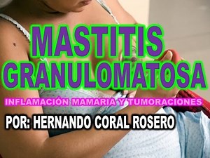 MASTITIS GRANULOMATOSA ( INFLAMACIÓN MAMARIA Y TUMORACIONES )
