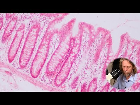 Histology of the large intestine (or colon)
