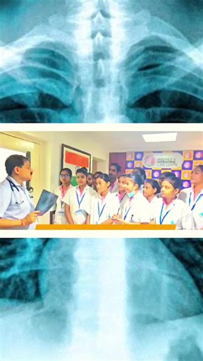 Understanding Chest X-ray Interpretations in Medicine