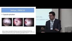 The Role of Capsular Plication for Hip Instability