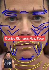 Denise Richards' New Face: What Changed?