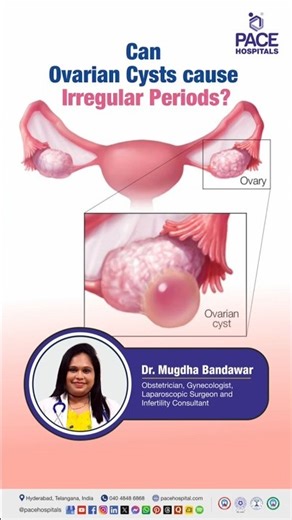 Can Ovarian Cysts cause Irregular Periods? | Ovarian Cysts and Irregular Periods #ovariancysts