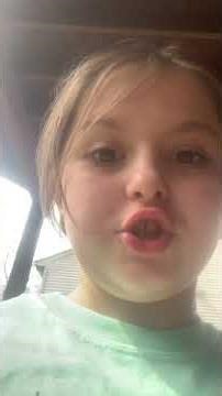 This dog is like Brody stop eating poop other dogs, eating poop