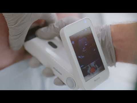 How to Perform Spinals & Epidurals with Accuro [Scouting Technique]