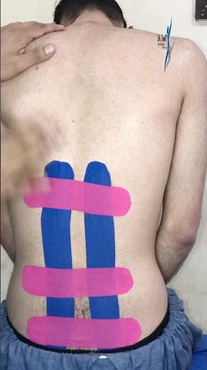Kinesiology Taping for Back Pain Relief | Easy Step-by-Step Technique | physiohut | Dr sami physio